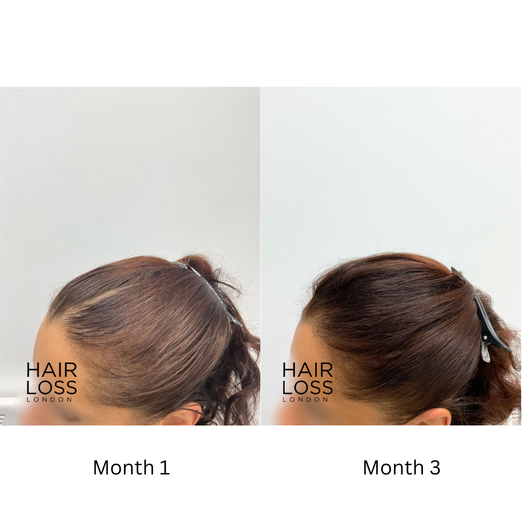 diet and nutrition for hair growth women