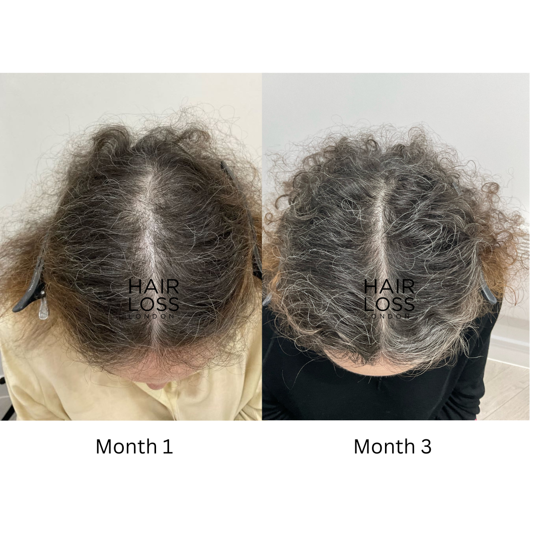 Trichologist London for women reviews