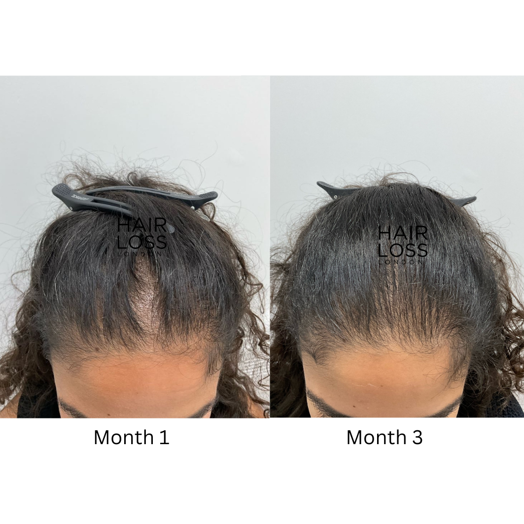 Hair Loss London reviews
