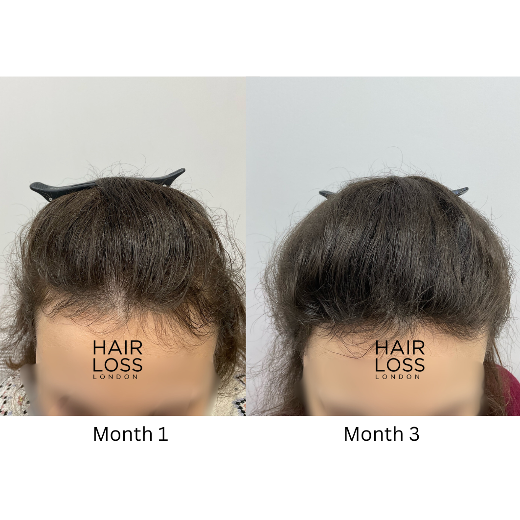 Hair Loss London reviews